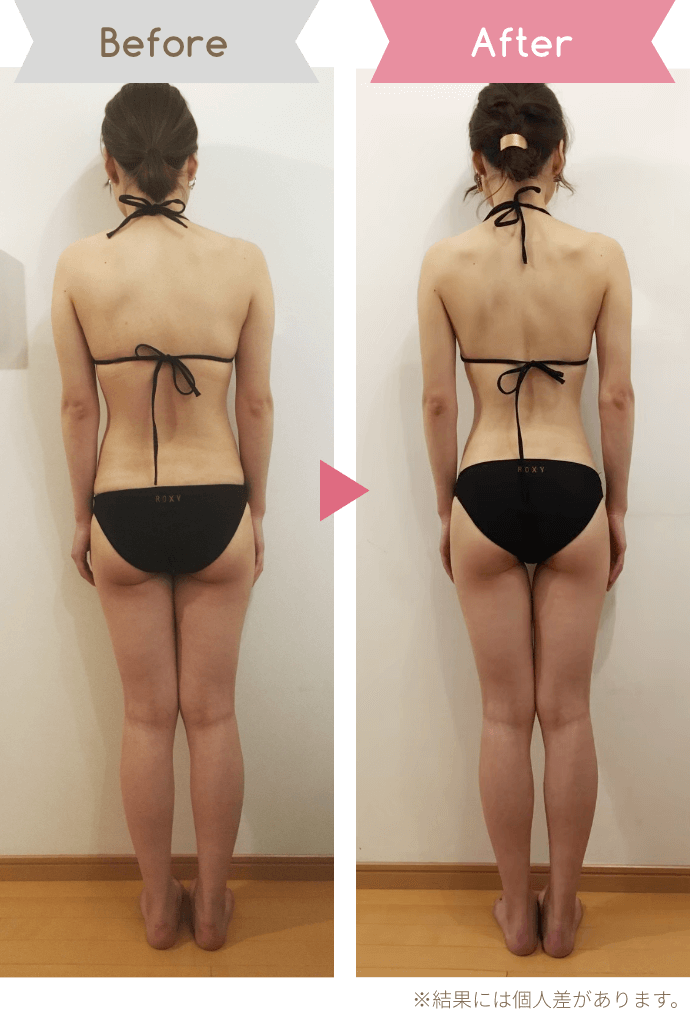 Before After ※結果には個人差があります。