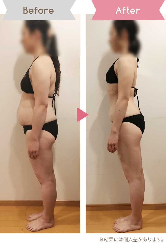 Before After ※結果には個人差があります。