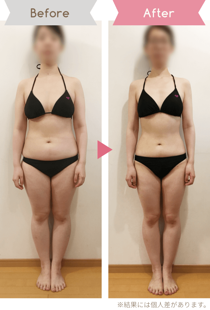Before After ※結果には個人差があります。