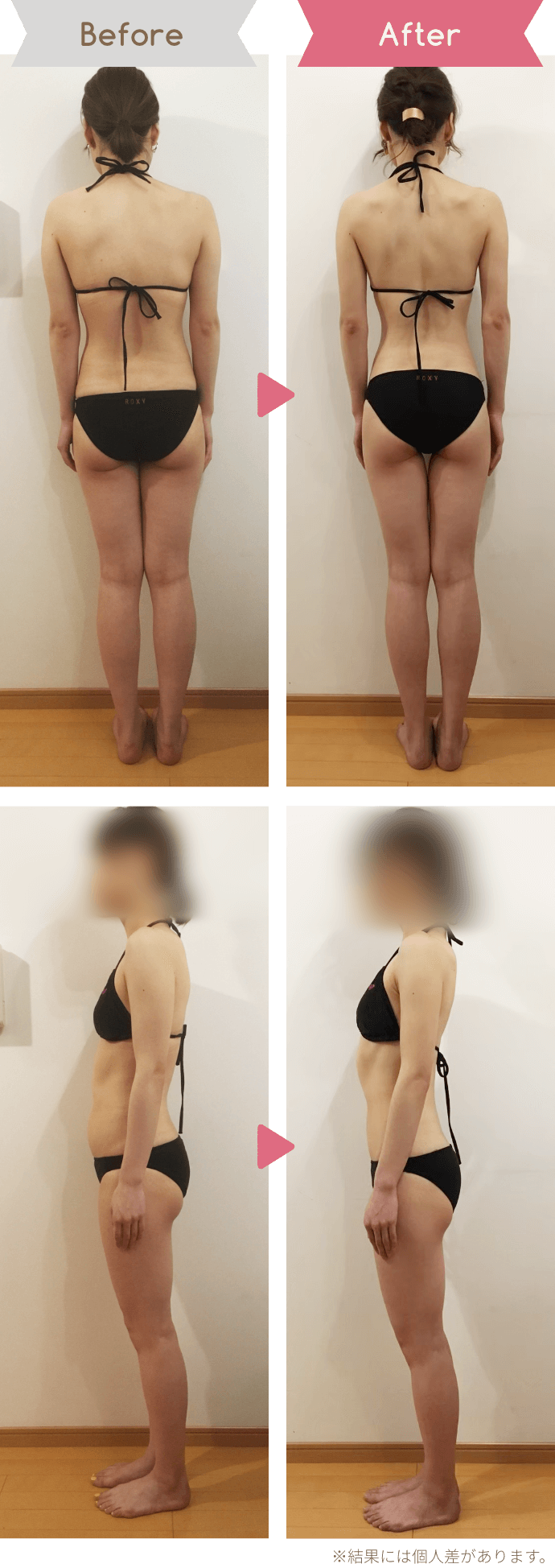Before After ※結果には個人差があります。