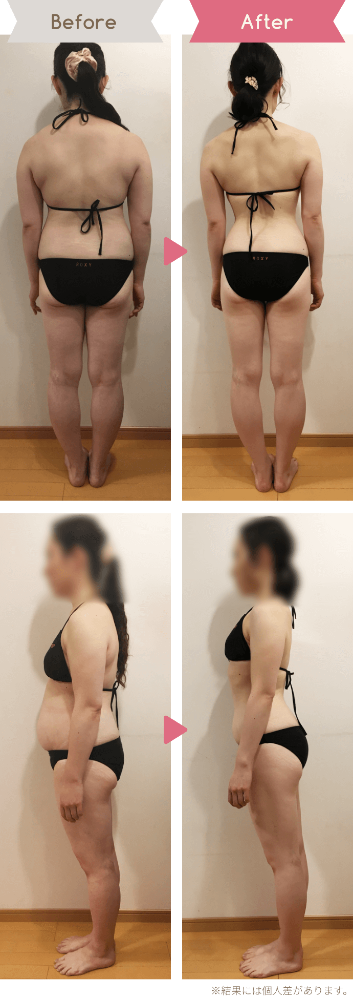 Before After ※結果には個人差があります。