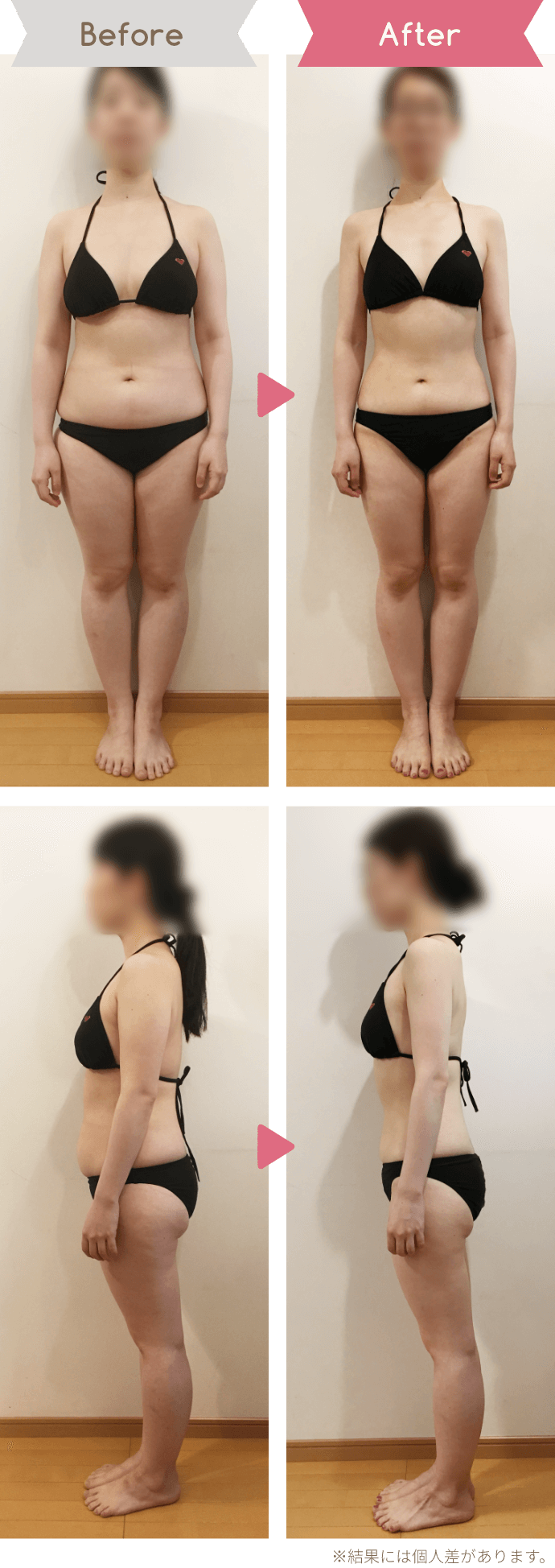 Before After ※結果には個人差があります。